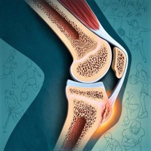 tendinopatia rotulea osteopata bergamo sebastian guzzetti ginocchio dolore